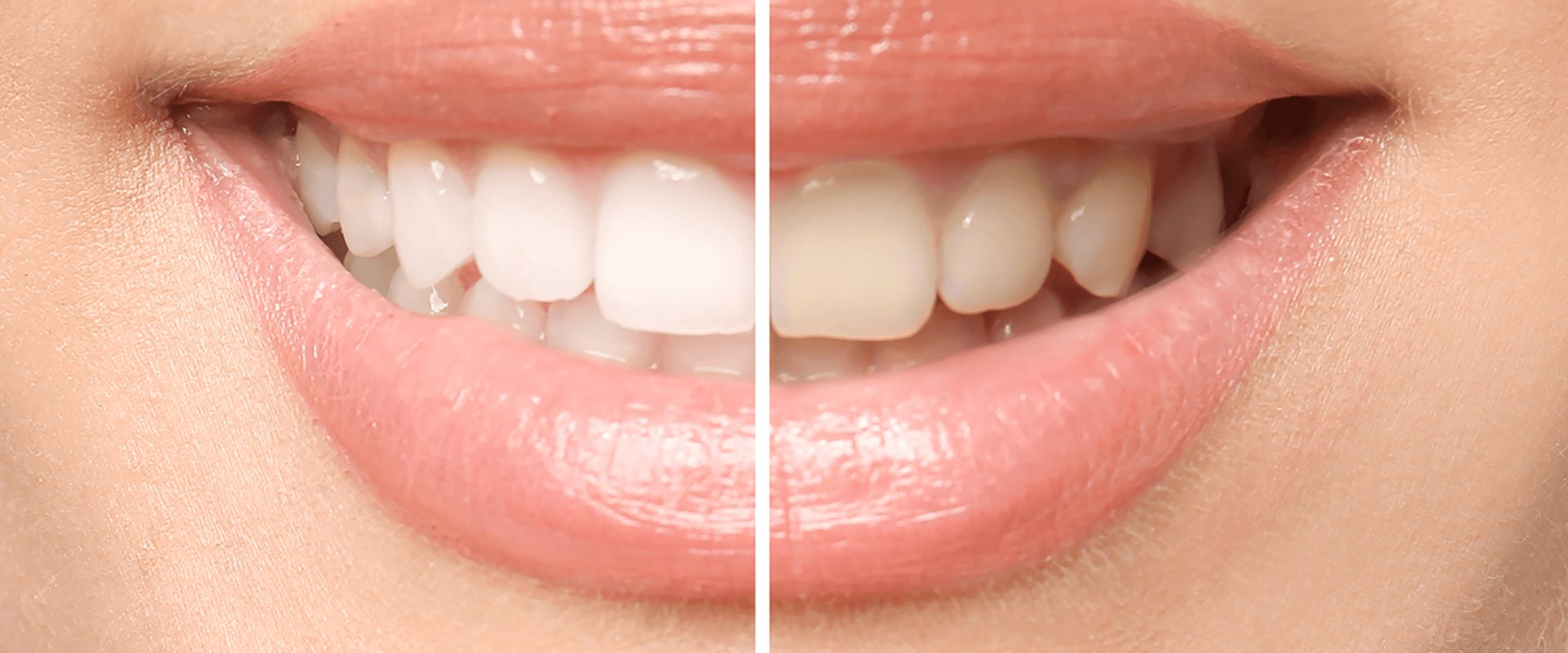 In-office Treatments for a Brighter Smile