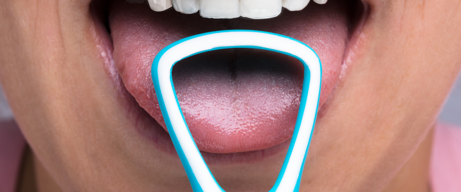 The Importance of Tongue Cleaning for Daily Oral Health Maintenance