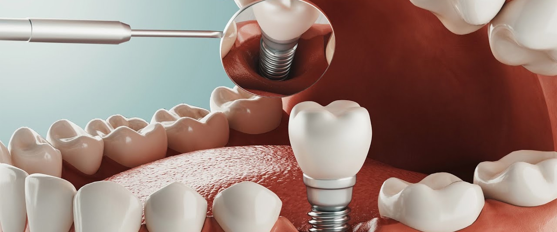 Improving Your Quality of Life: The Benefits of Restorative Dentistry