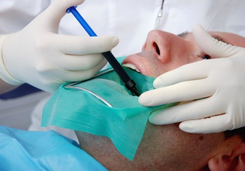 Understanding Root Canals: A Comprehensive Guide to Dental Procedures