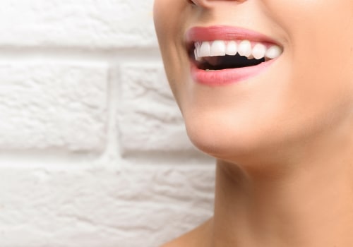 Exploring the Benefits of Bonding for Beautiful Smiles